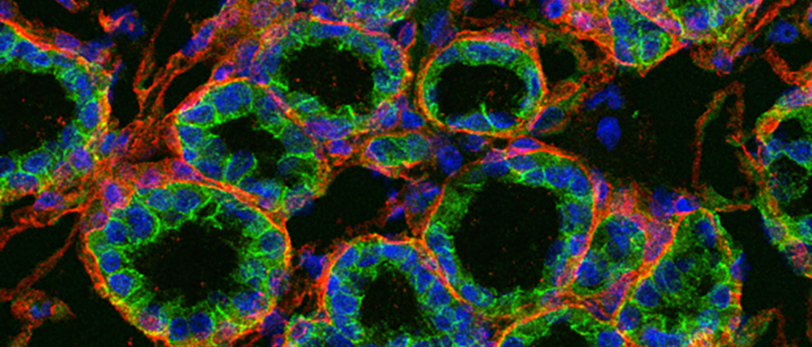 Helsinki-epiphelial-cell-growth.png